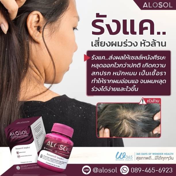 Alosol ผม